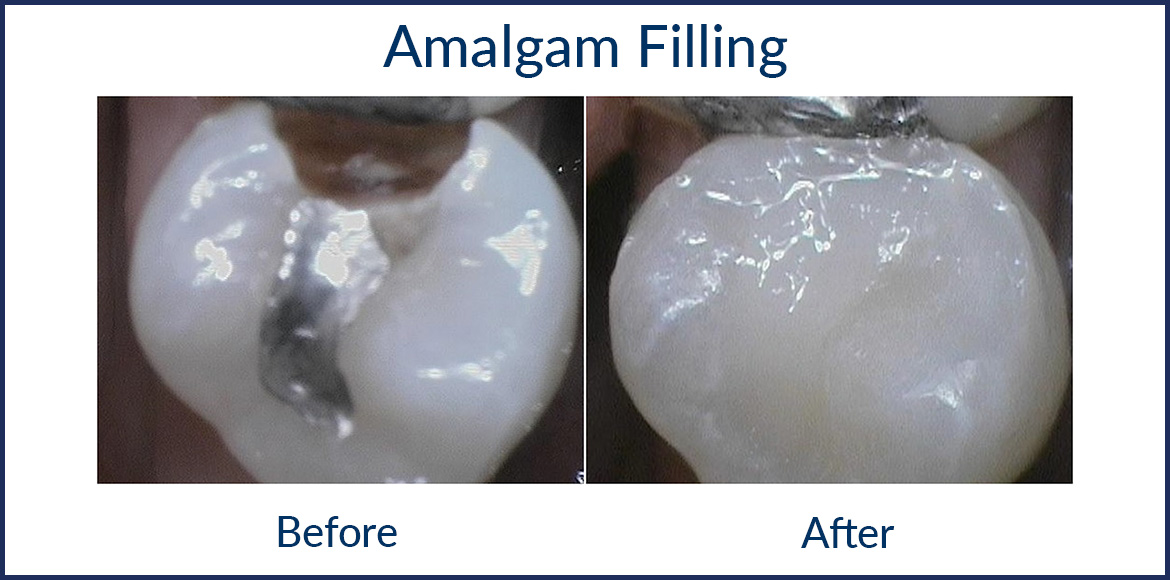 Before and After Connecticut Family Dentistry